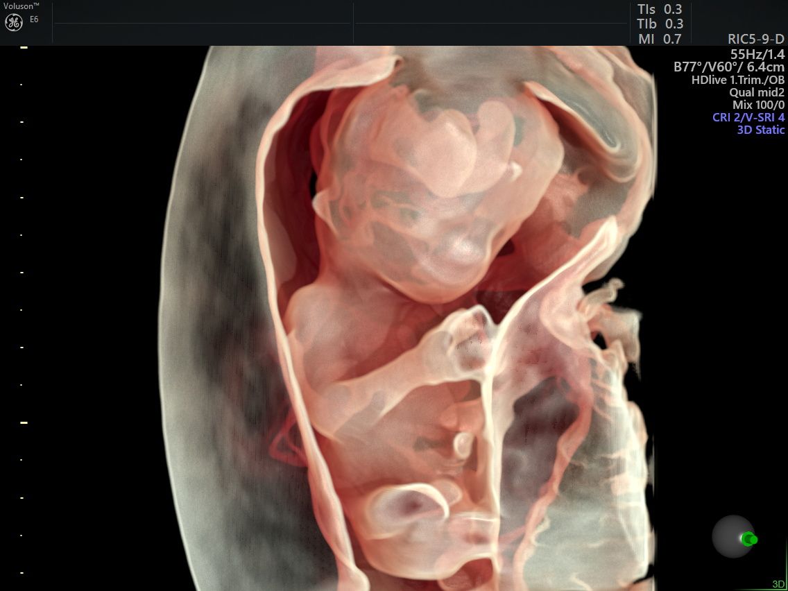 Gila Lili Barrientos Chavez-6