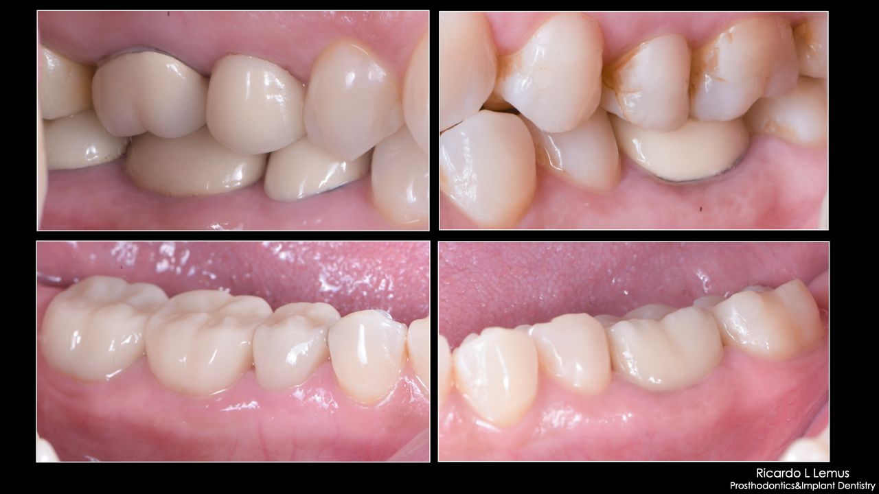 Ricardo López Lemus-119