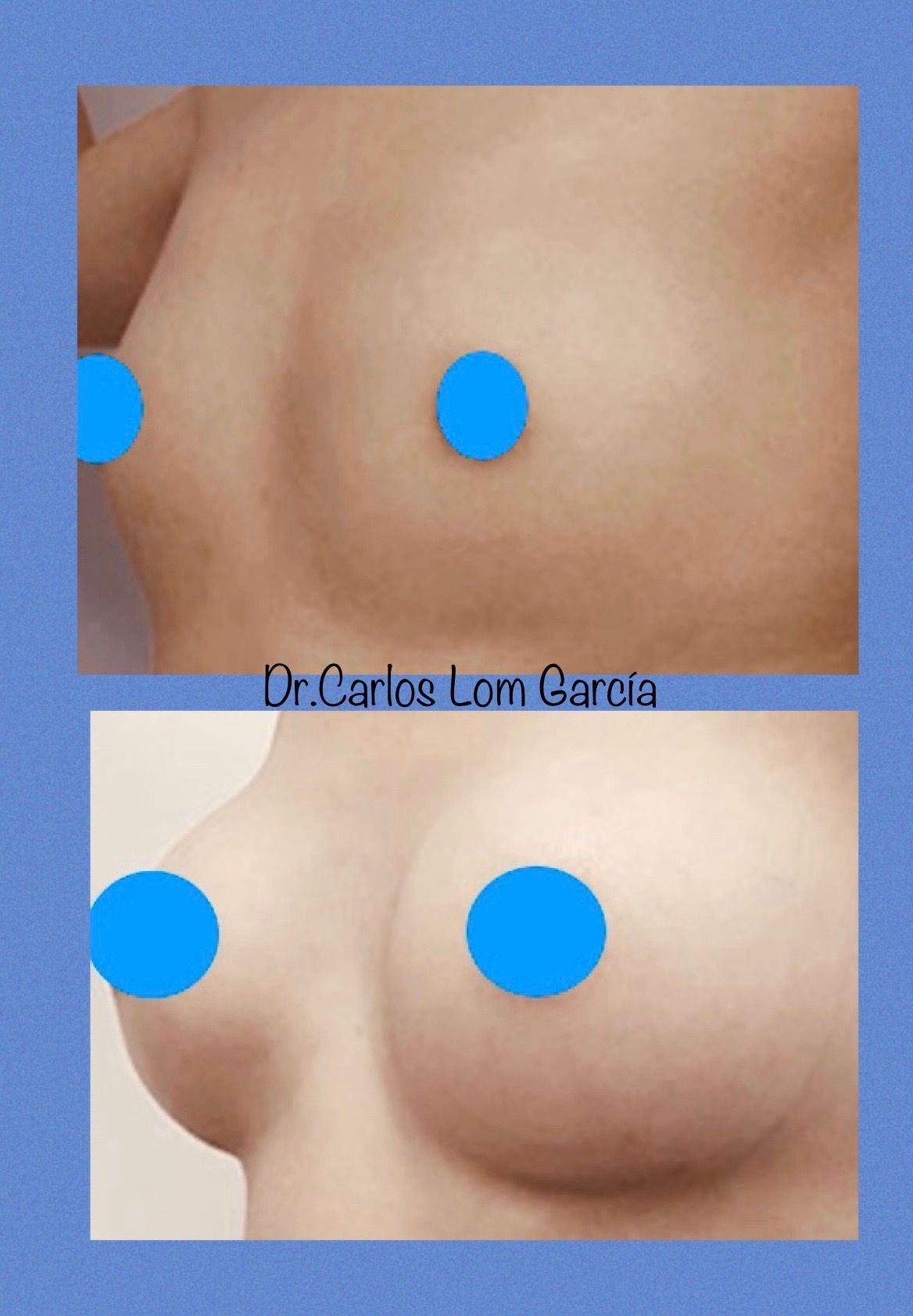 Carlos Lom García-4