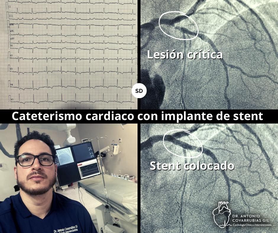 Antonio Covarrubias Gil-14