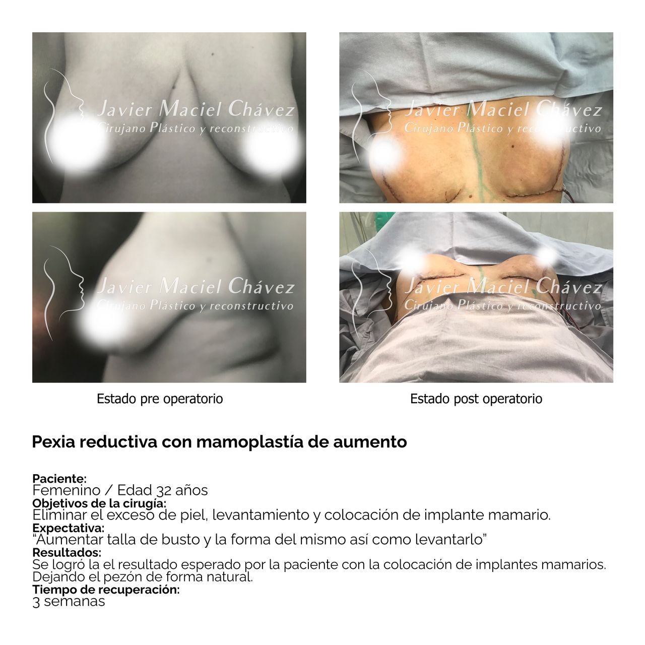 Javier Maciel Chávez-19