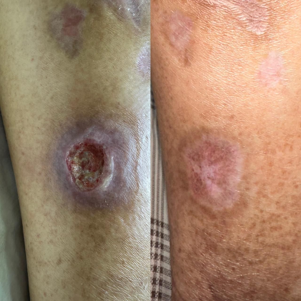 Jhonatan López González-44