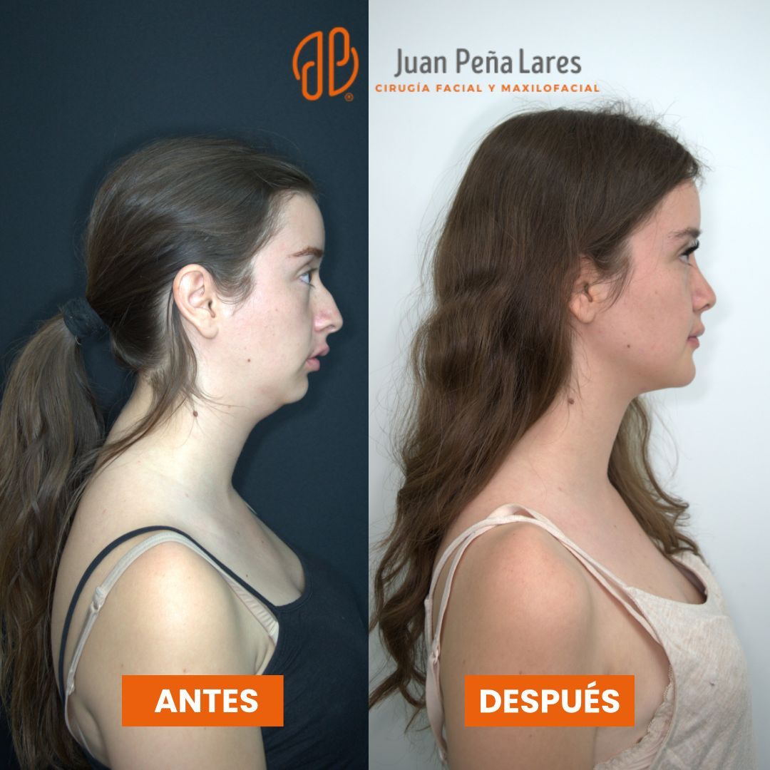Juan Peña Lares-9
