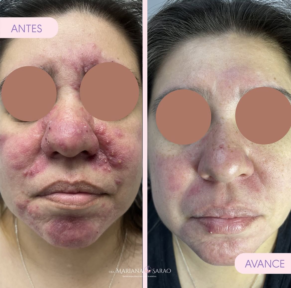 Mariana Sarao Pineda-4