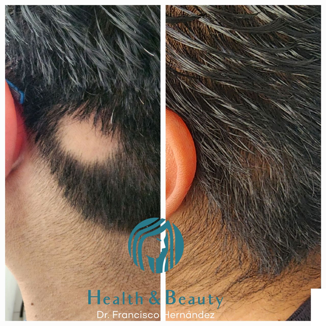 Francisco Hernández Gómez Crespo-76