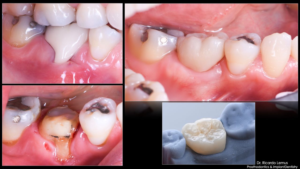 Ricardo López Lemus-9