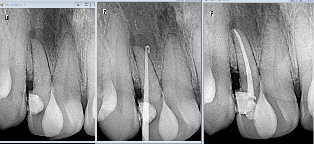 Lesli Erendira Campechano Zaragoza-12