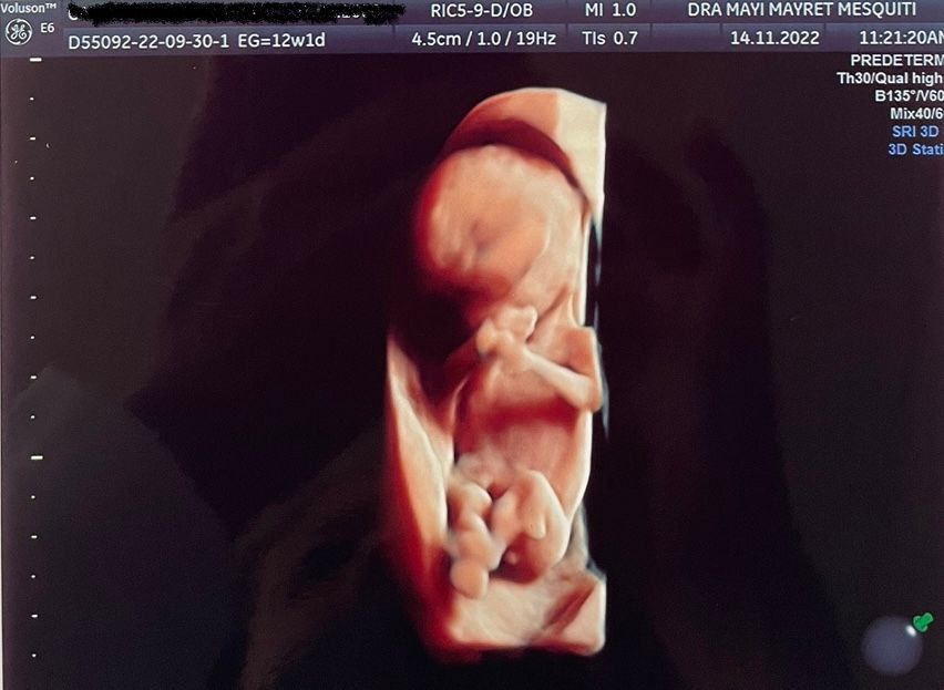 Mayi Mayret Mesquiti-11