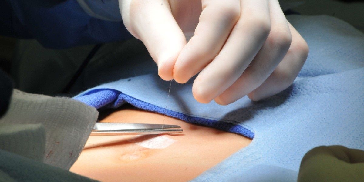 Miguel Angel Rico Hinojosa-8