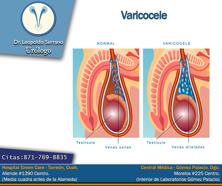 Erik Leopoldo Serrano Ortega-24