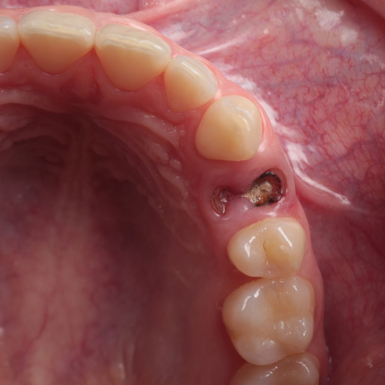 Fernando Fuentes Lozada-11