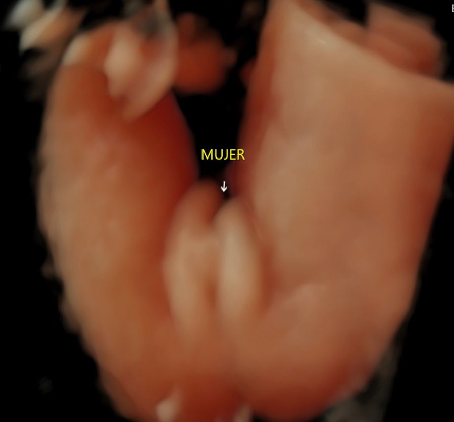 Gustavo Gómez Sánchez-3