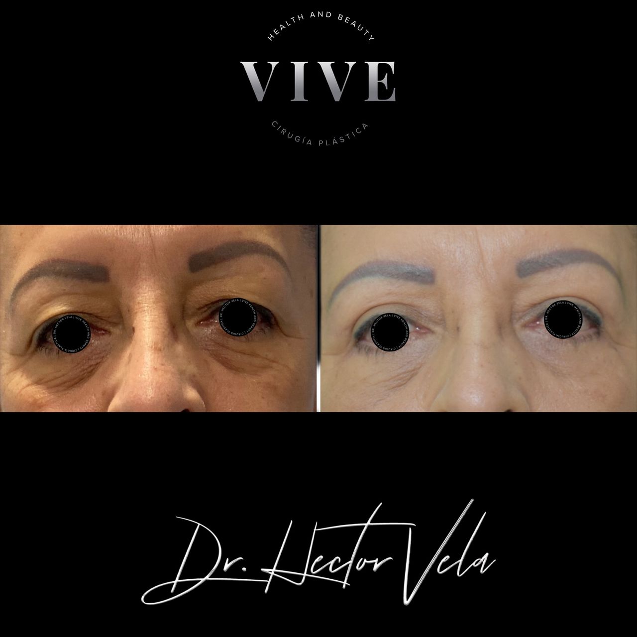 Héctor Eduardo Vela Cardona-170