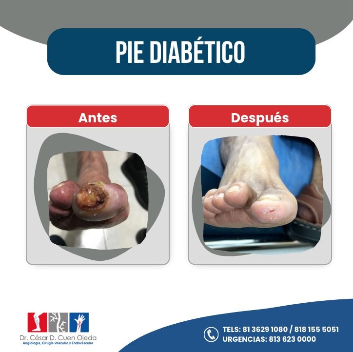 César Daniel Cuen Ojeda-16