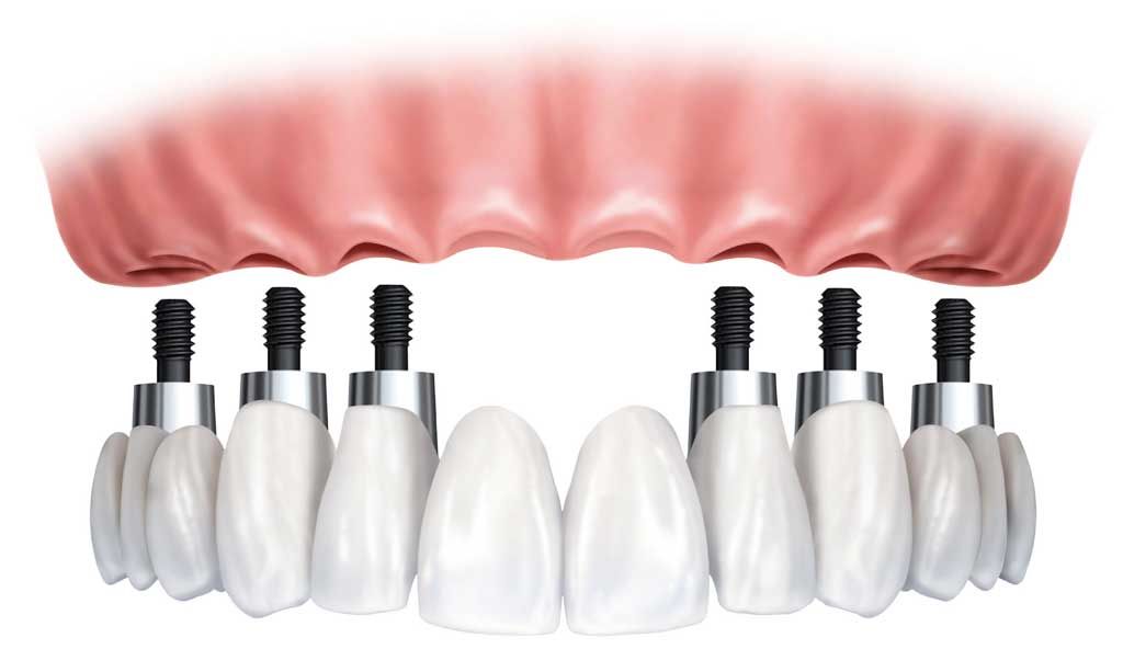 Luis Humberto Garcia Cabrera-0