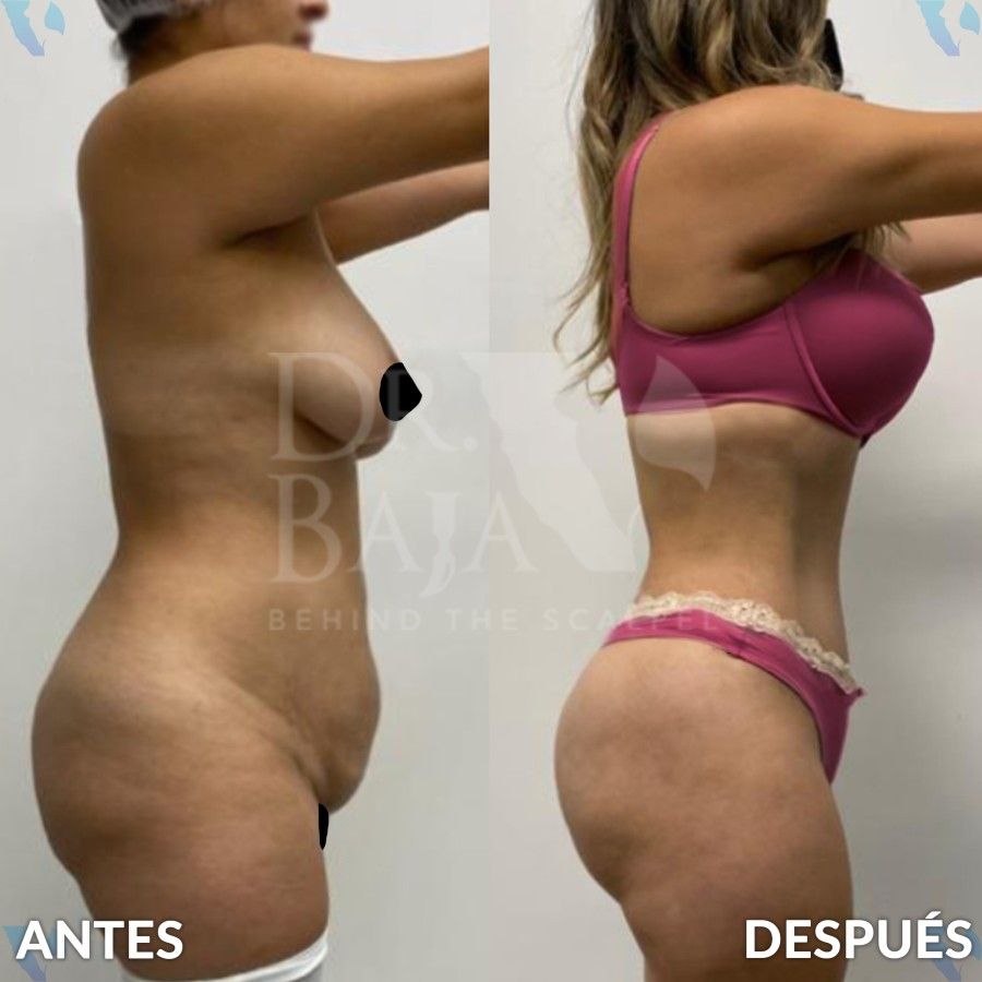 Renato Rodríguez Hirales-22