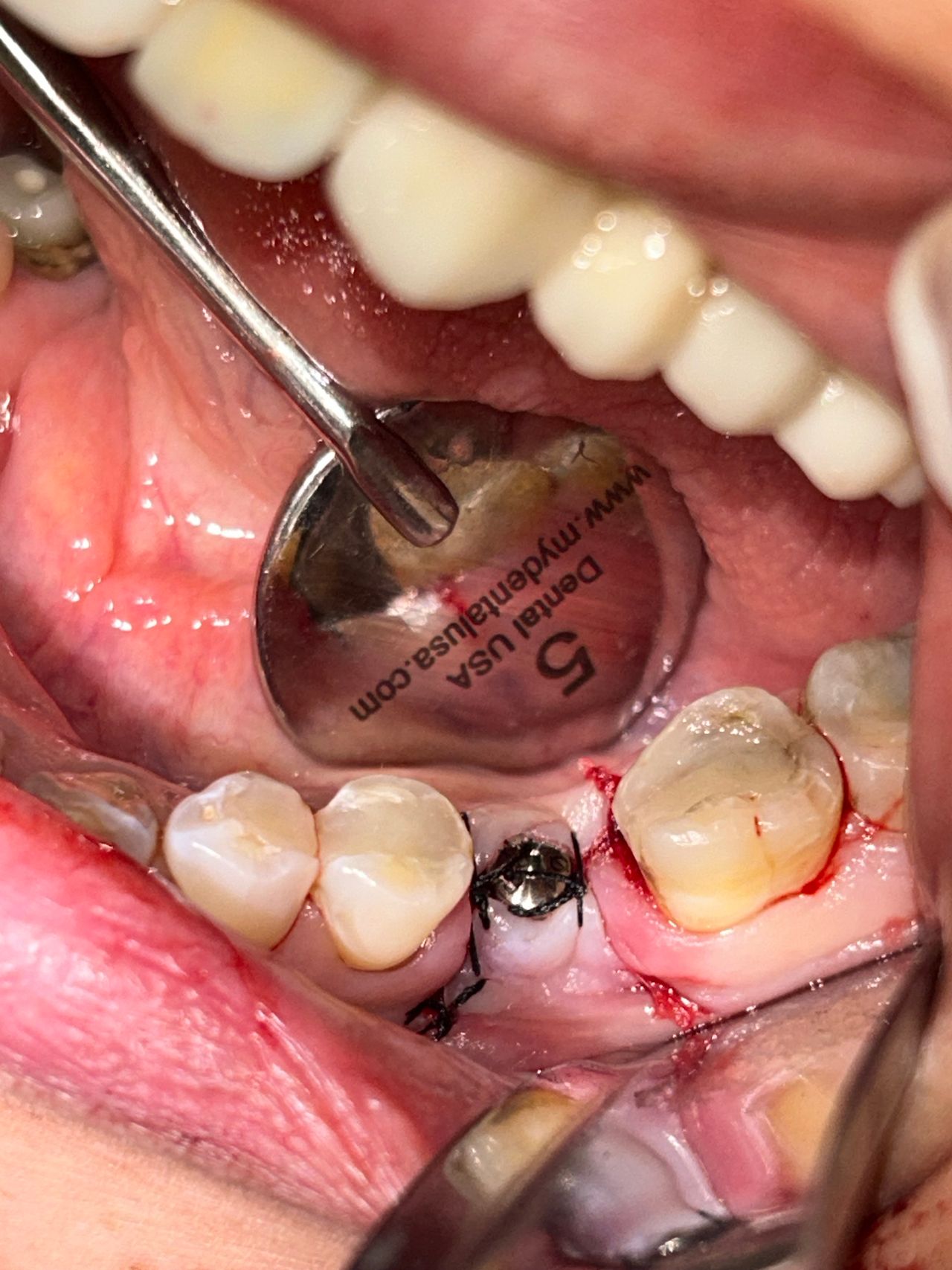 Mauricio Burgos Sánchez-16