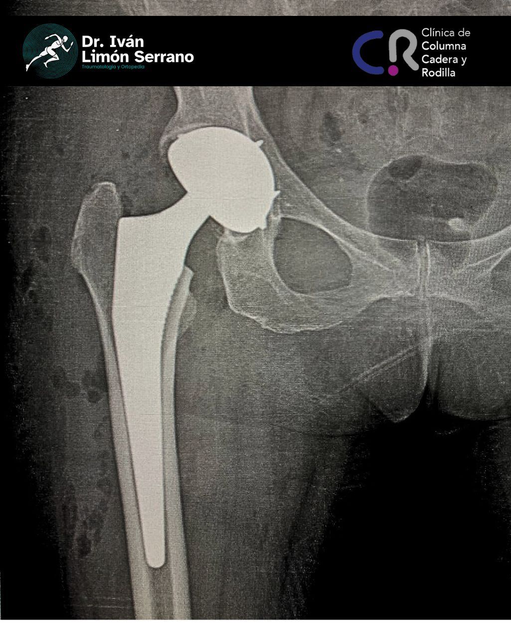 Iván Limón Serrano-35