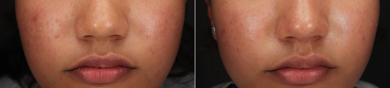 Lauro Francisco Varela Coronado-9