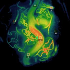 Alejandro Serrano Rubio-10