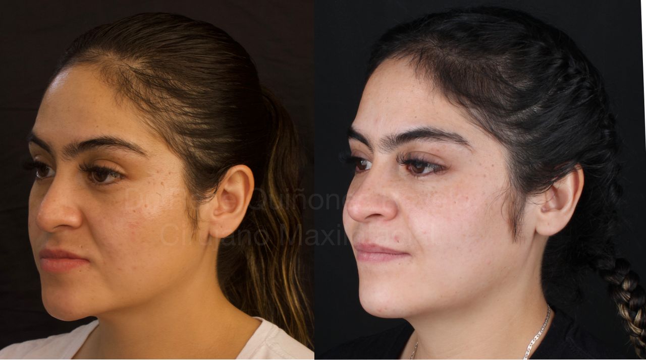 René Quiñones  Ravelo-6