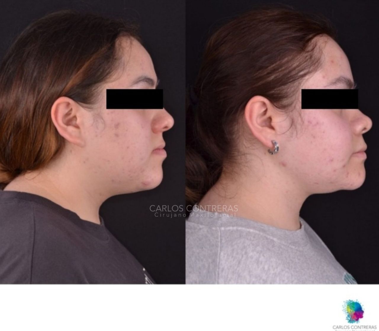 Carlos Ernesto Contreras Castellanos-36