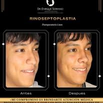 Enrique Serrano Cruz-8