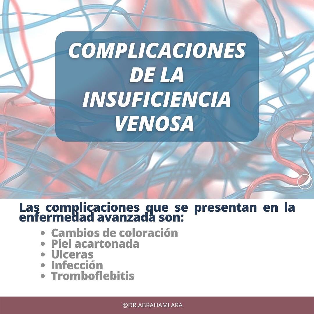 Miguel Abraham Lara Perez-37