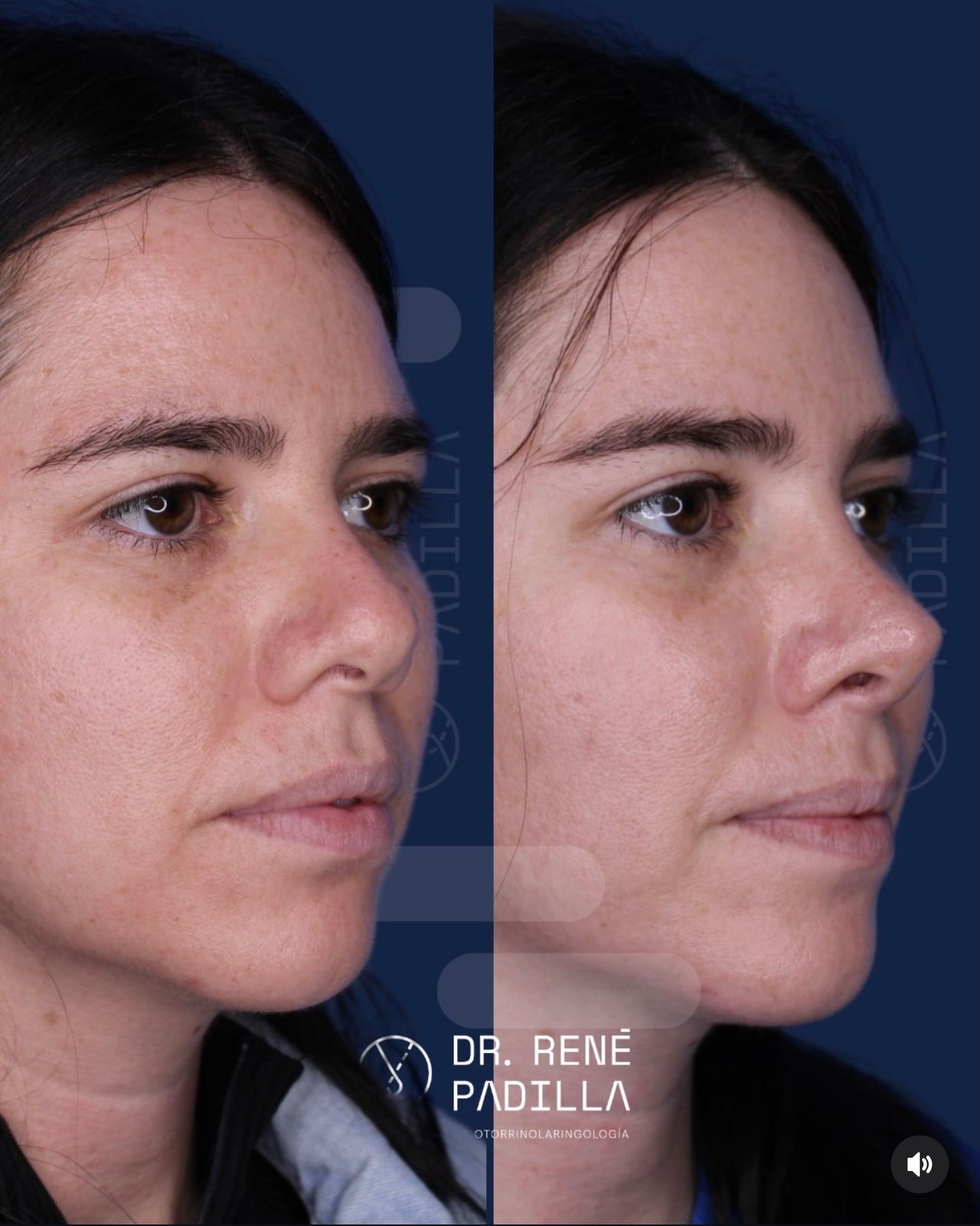 René Emmanuel Padilla López-2