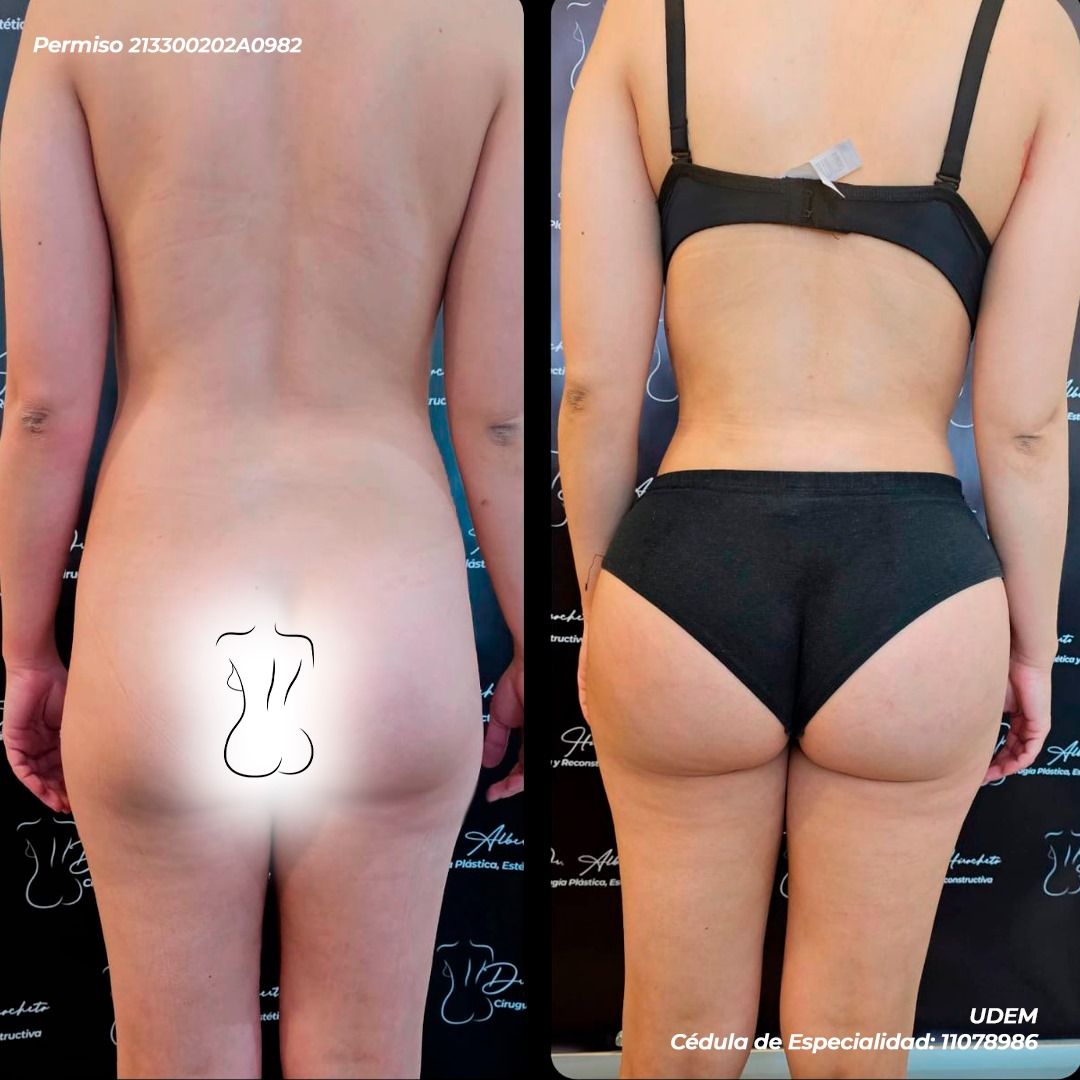 Alberto Hiracheta Torres-18