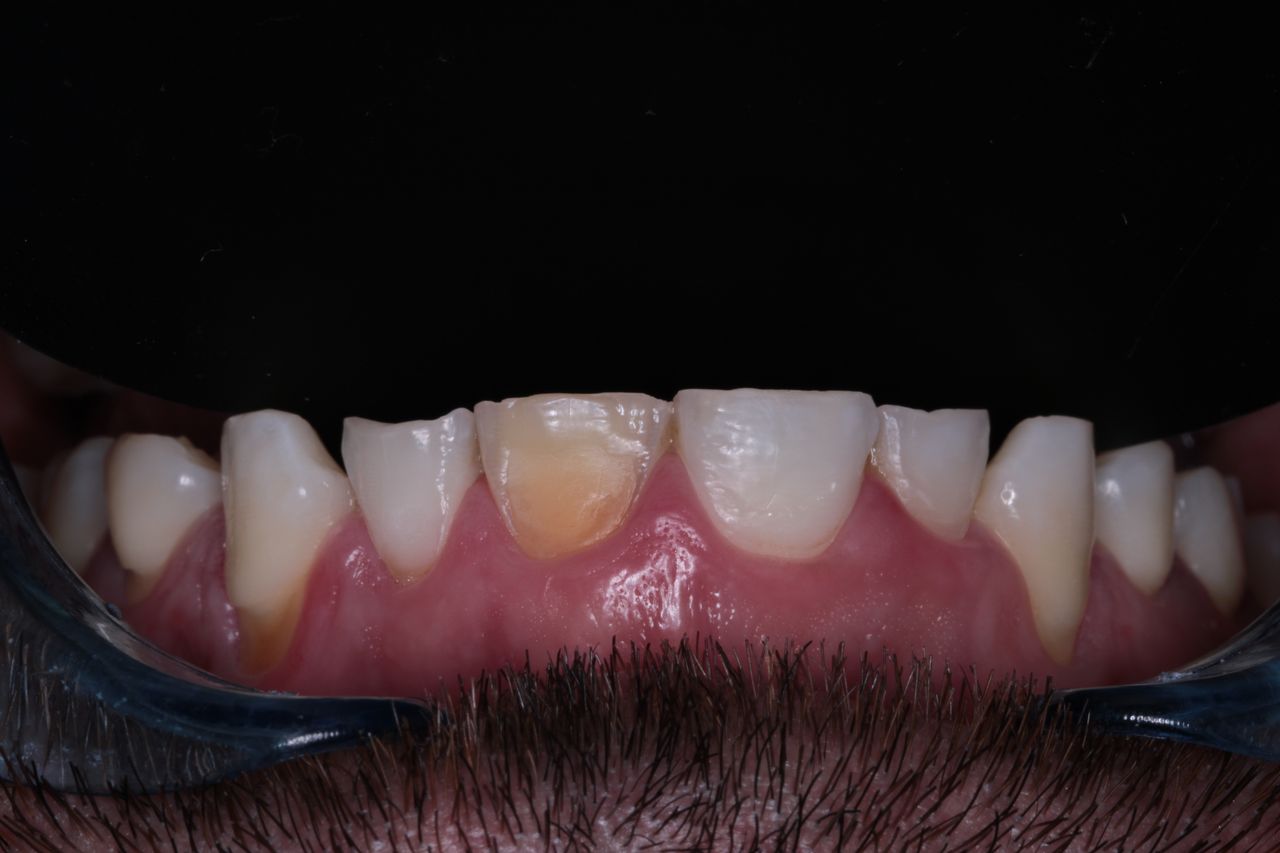 David Alan Escamilla Álvarez-4