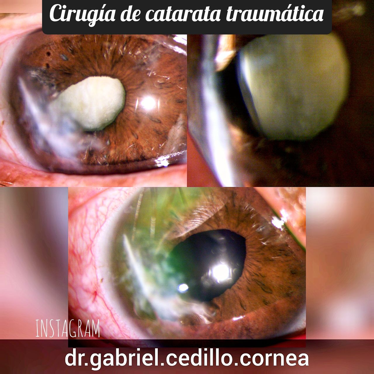 Héctor Gabriel Cedillo García-27