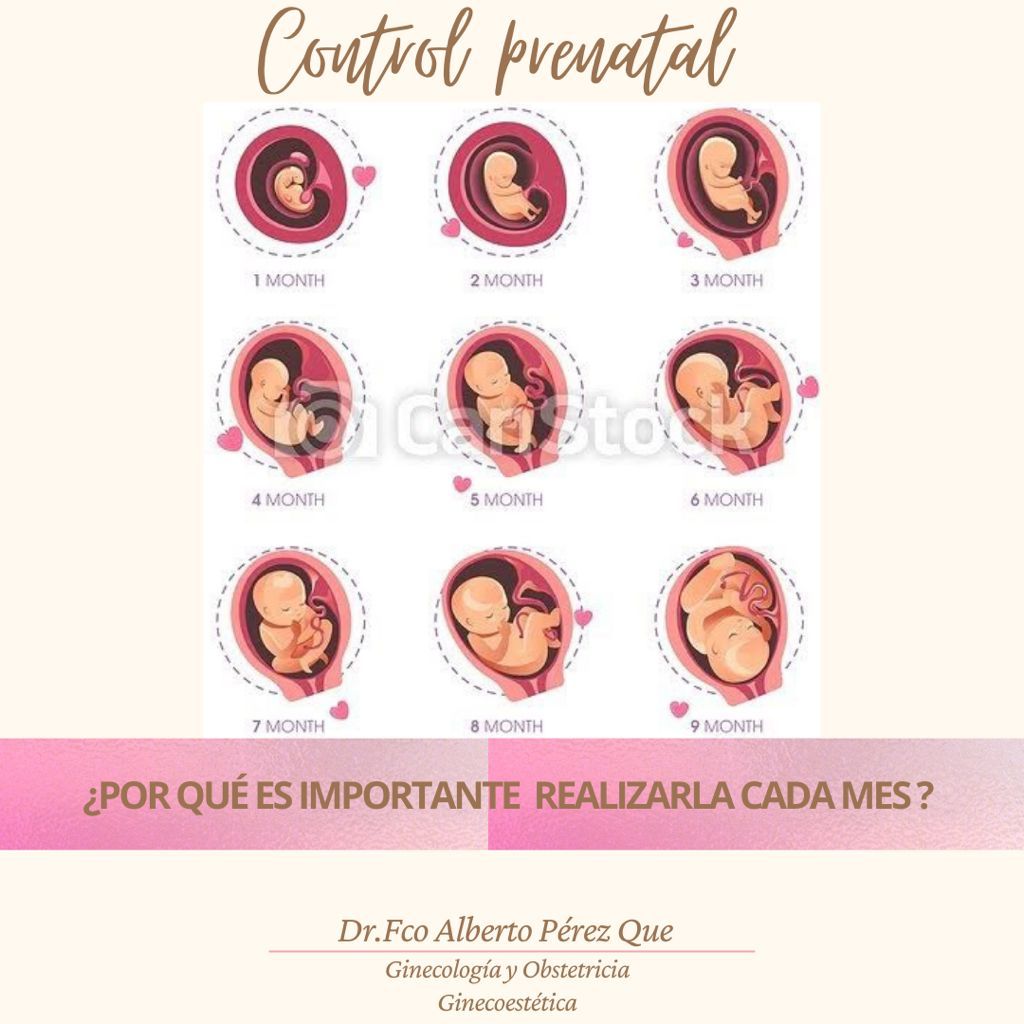 Francisco Alberto Perez Que-14