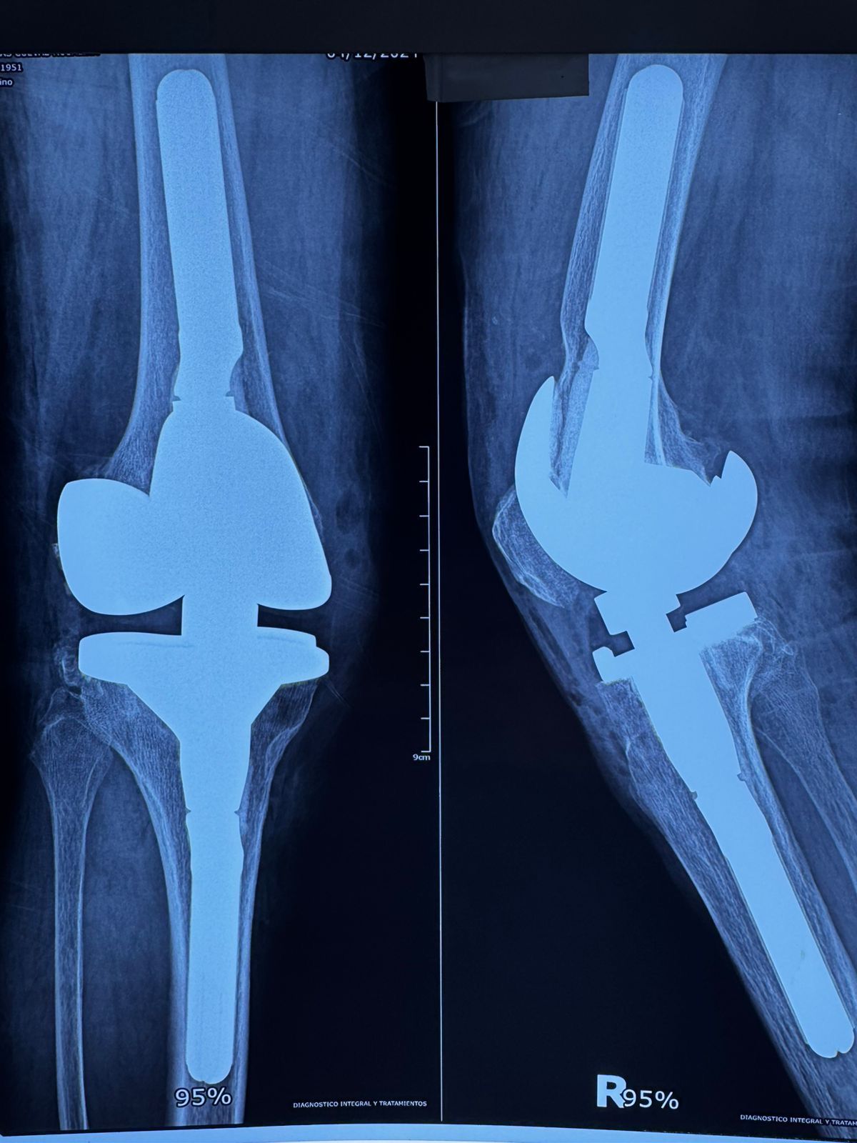 Cristian Ernesto Murillo Medina-12