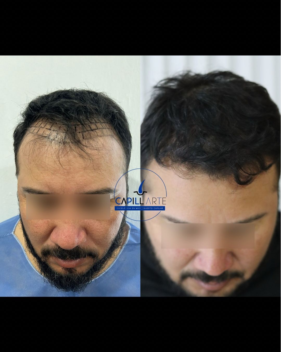 Adrian Hernandez Lopez-17