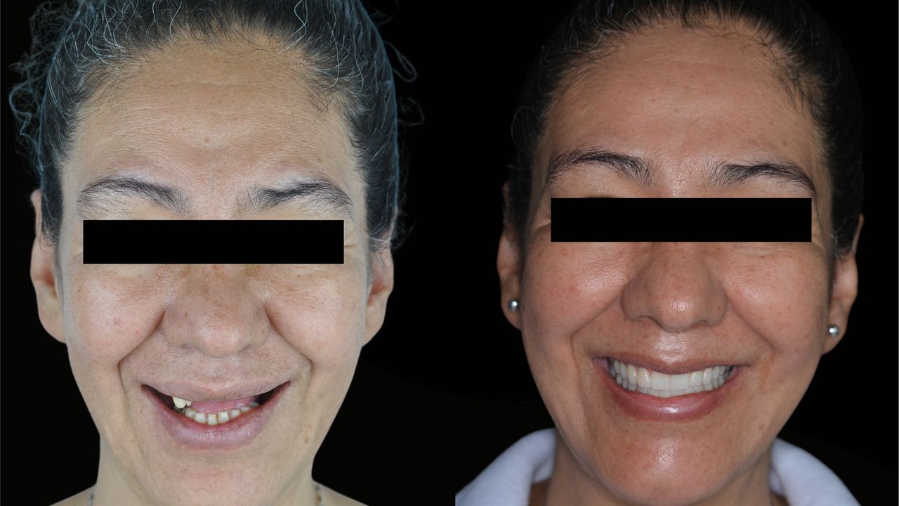 Joel Alejandro Sánchez Zúñiga-3