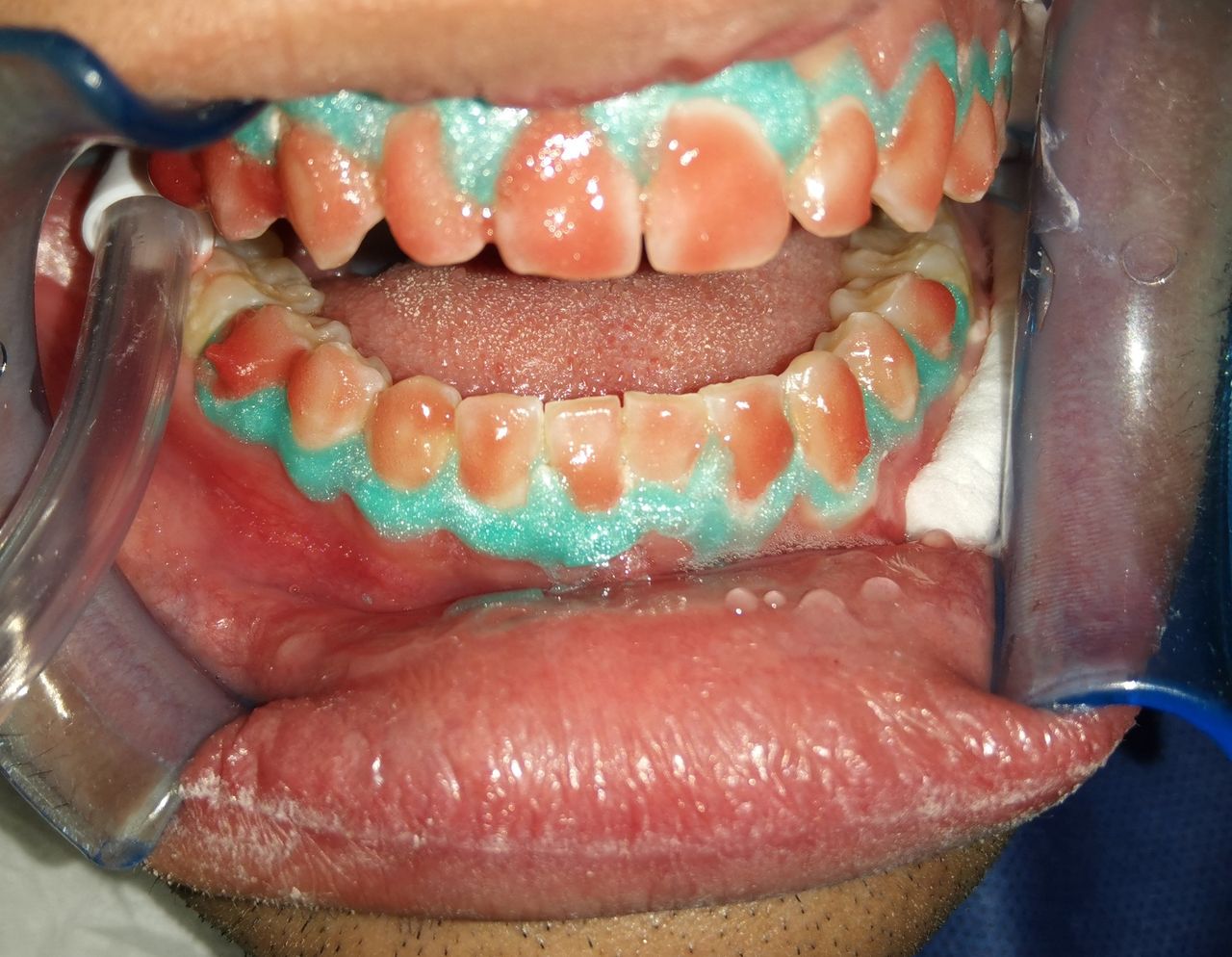 Alejandro Alcocer Flores-22