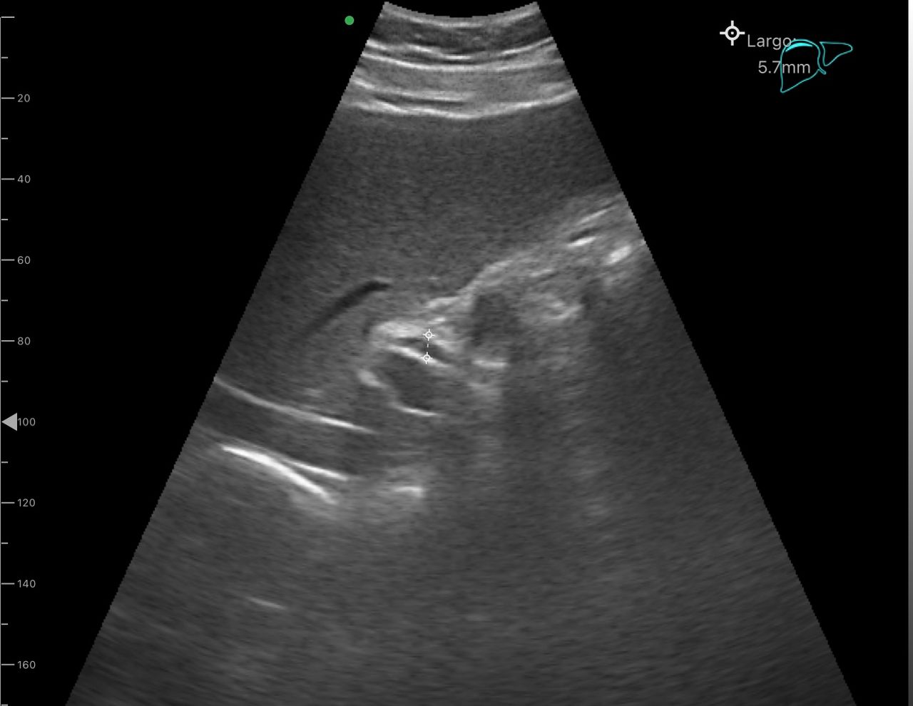 Juanita Pérez Escobar-7