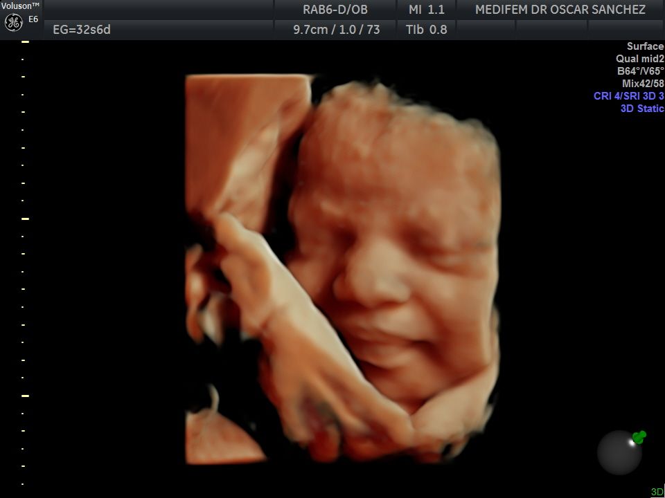 Oscar Alejandro Sánchez Gámez-17