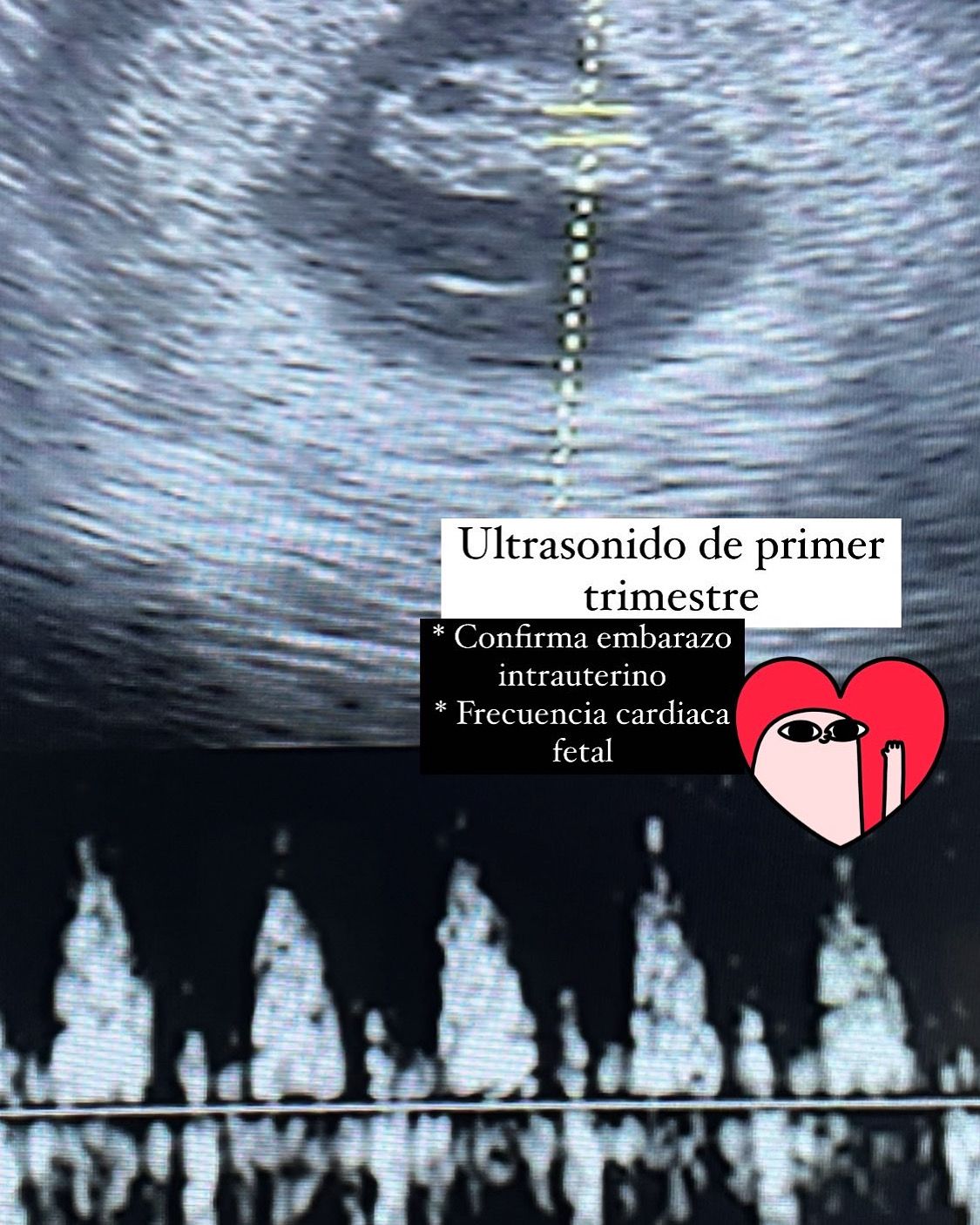 Adriana Tapia Nañez-5