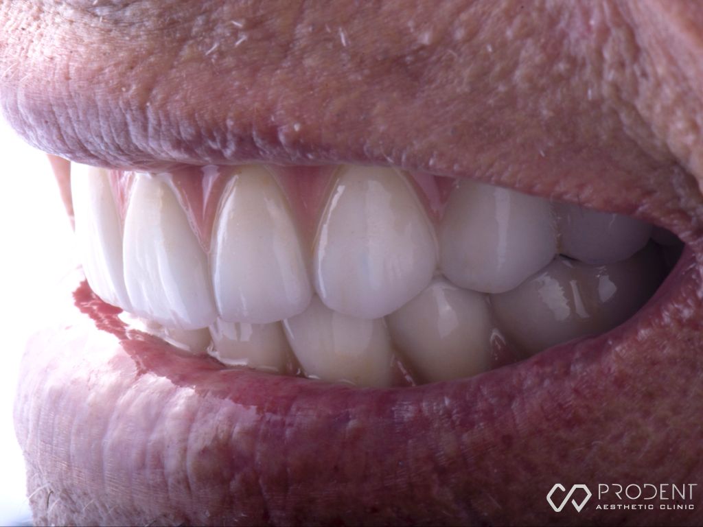 Ulises Pérez Murillo-106