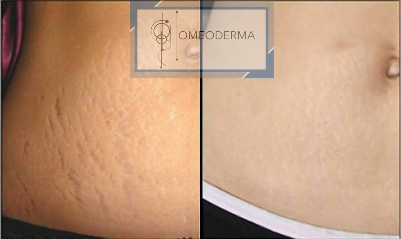 Gilliar Emmanuel Eudave De Lima-7