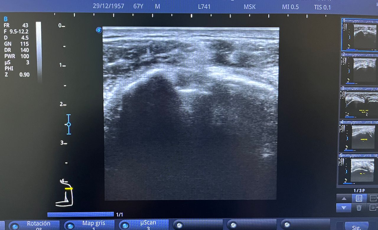 César Guerra Martínez-50