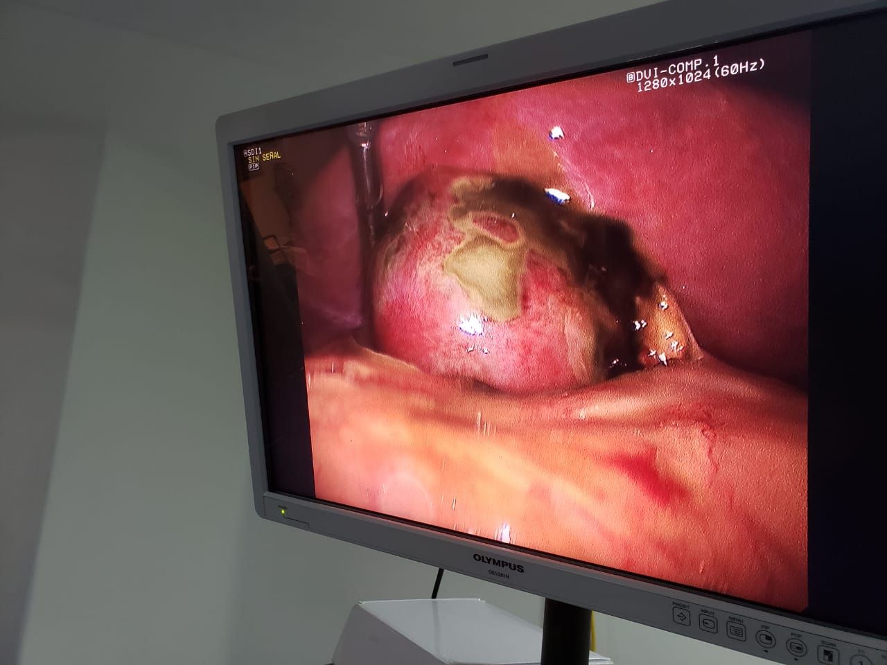 Luis Angel Medina Andrade-16