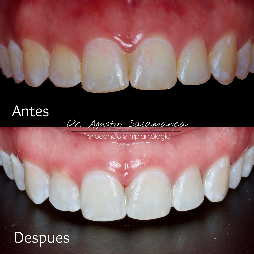 Agustin Salamanca Tapia-20