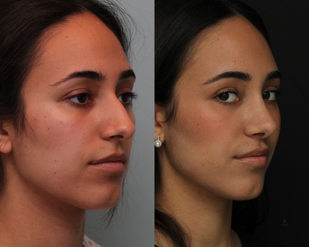 Angel Castro Urquizo-79