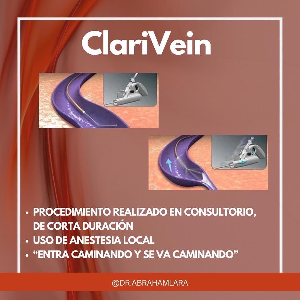 Miguel Abraham Lara Perez-32