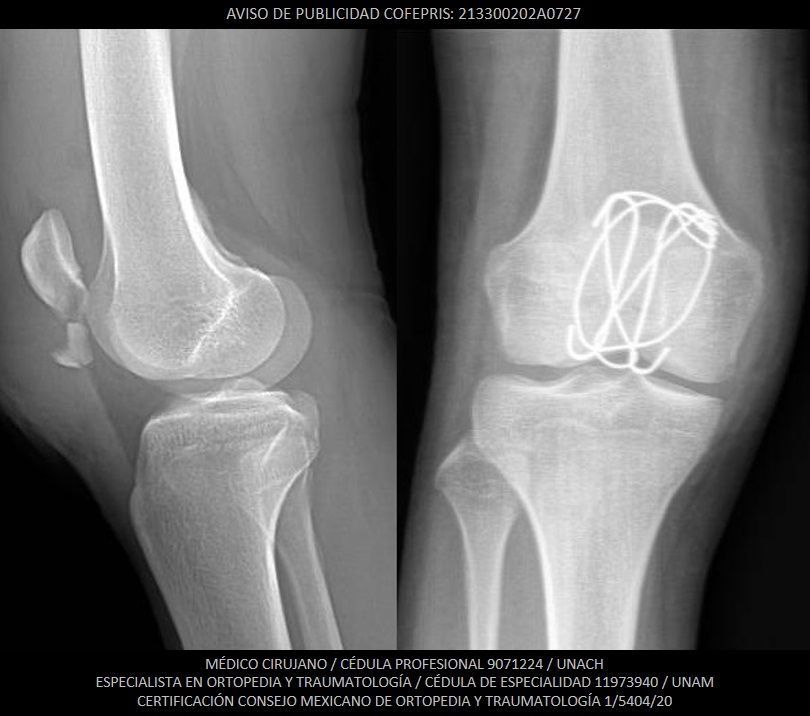 Luis Castañón Robles-7
