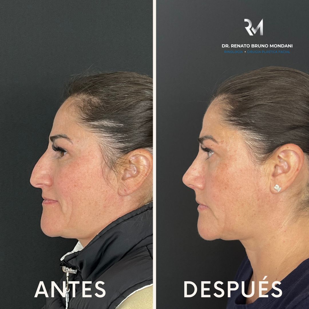 Renato Bruno Mondani-3