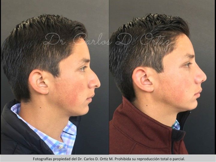 Carlos David Ortiz Moreno-31